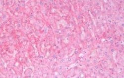 KRAS Antibody, Novus Biologicals 50 &mu;g | Buy Online | Novus Biologicals | Fisher Scientific